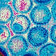 Illustration for article titled Bagaimana Cara Mengatasi Penyakit Herpes